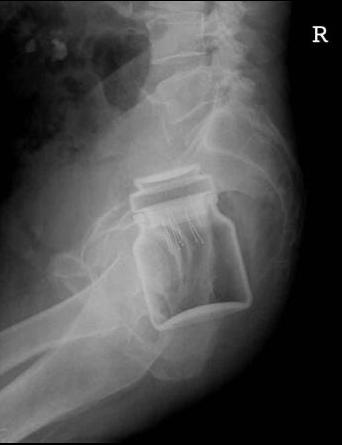 radiografie6.jpg