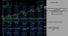 nasdaq10013-11-2013 07-28-31.png