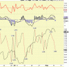 cpci al 11-08.gif