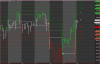 mib1hadm180314.PNG