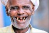 denti.jpg