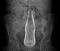 radiografia.JPG