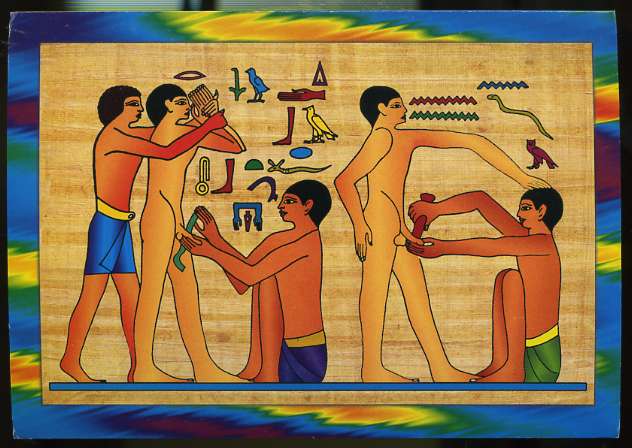 Circumcision_Egypt.jpg