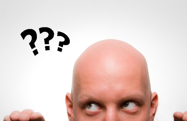 uomo-calvo_227429.630x360.jpg