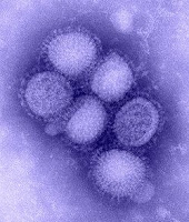 250px-H1N1_influenza_virus.jpg